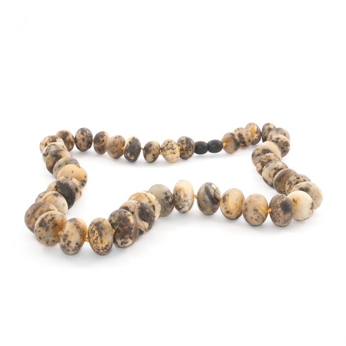 amber-necklace-unpolished-buttons amber-necklace-unpolished-buttons