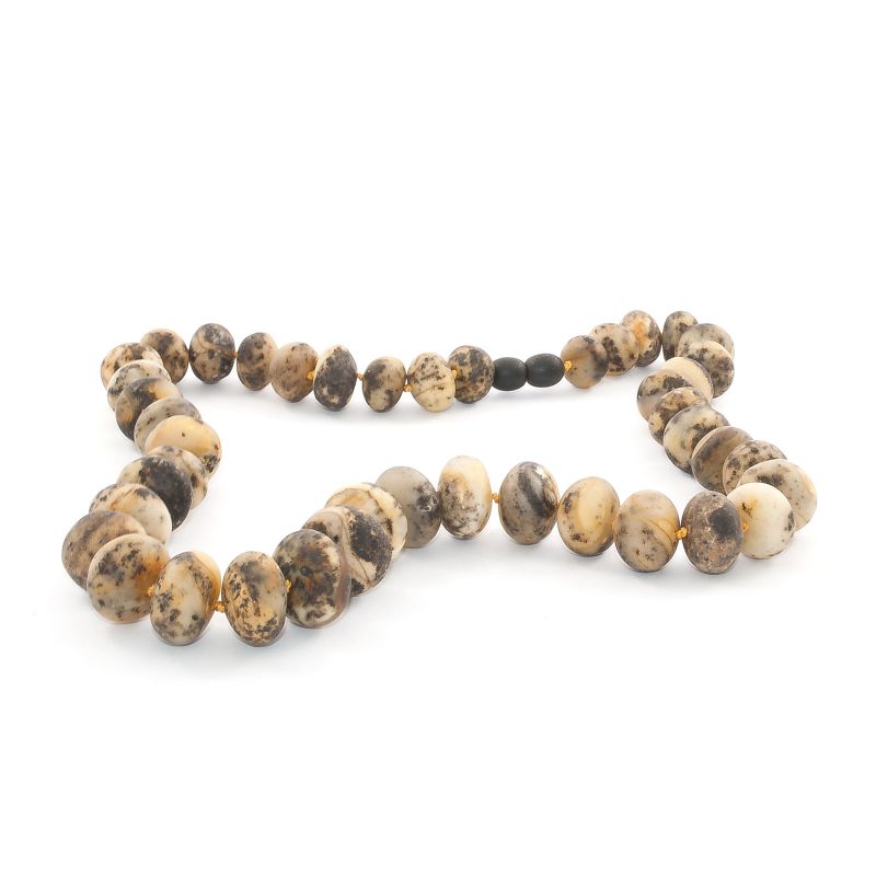 amber-necklace-unpolished-buttons